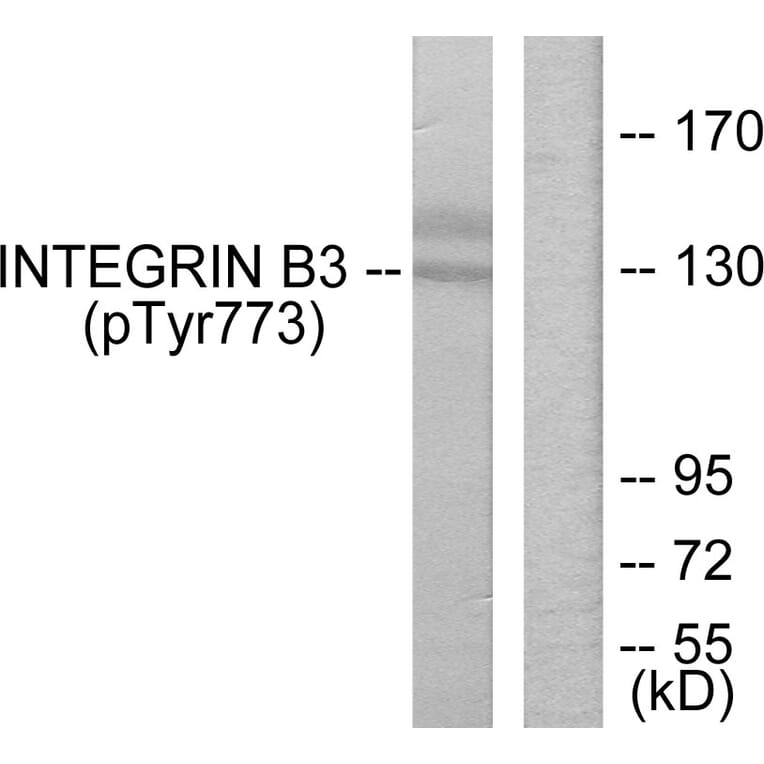 Western Blot - Anti-Integrin beta3 (phospho Tyr773) Antibody (A7118) - Antibodies.com