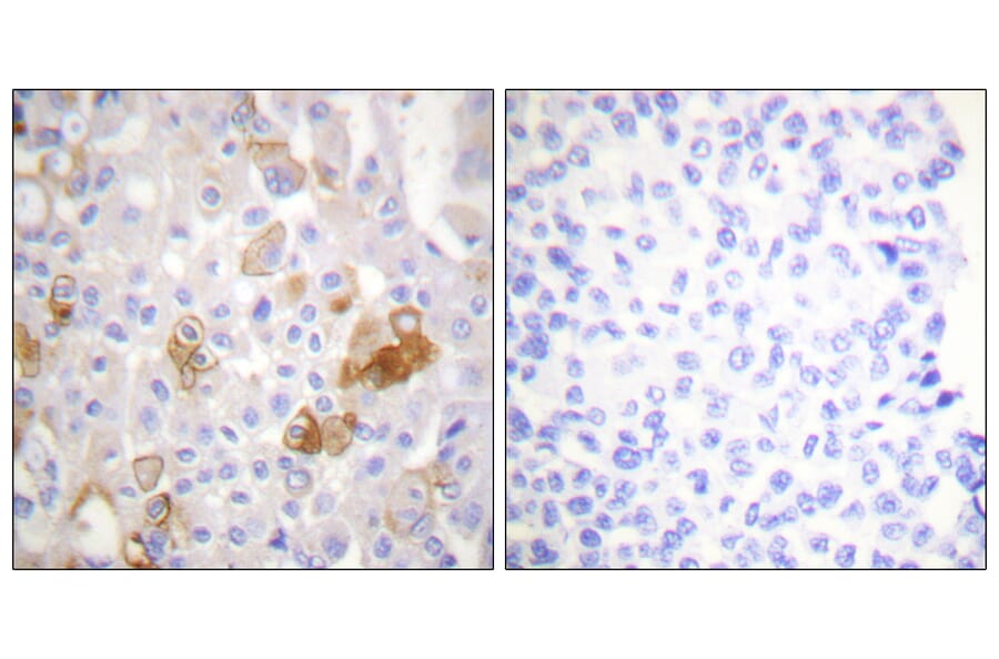 Immunohistochemistry - Anti-Integrin beta1 (phospho Thr788) Antibody (A0445) - Antibodies.com