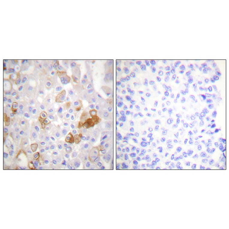 Immunohistochemistry - Anti-Integrin beta1 (phospho Thr788) Antibody (A0445) - Antibodies.com