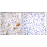 Immunohistochemistry - Anti-Integrin beta1 (phospho Thr788) Antibody (A0445) - Antibodies.com