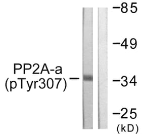 Western Blot - Anti-PP2A-alpha (phospho Tyr307) Antibody (A0555) - Antibodies.com
