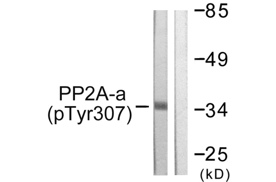 Western Blot - Anti-PP2A-alpha (phospho Tyr307) Antibody (A0555) - Antibodies.com