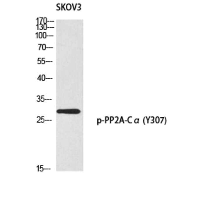Western Blot - Anti-PP2A-alpha (phospho Tyr307) Antibody (A0555) - Antibodies.com