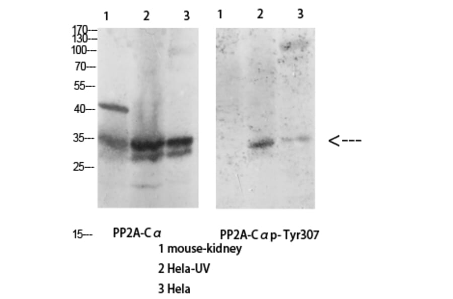Western Blot - Anti-PP2A-alpha (phospho Tyr307) Antibody (A0555) - Antibodies.com