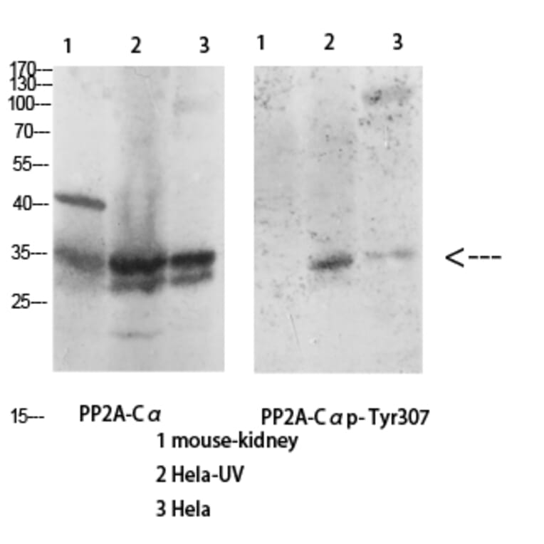 Western Blot - Anti-PP2A-alpha (phospho Tyr307) Antibody (A0555) - Antibodies.com