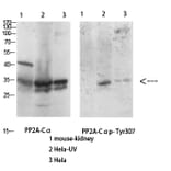 Western Blot - Anti-PP2A-alpha (phospho Tyr307) Antibody (A0555) - Antibodies.com