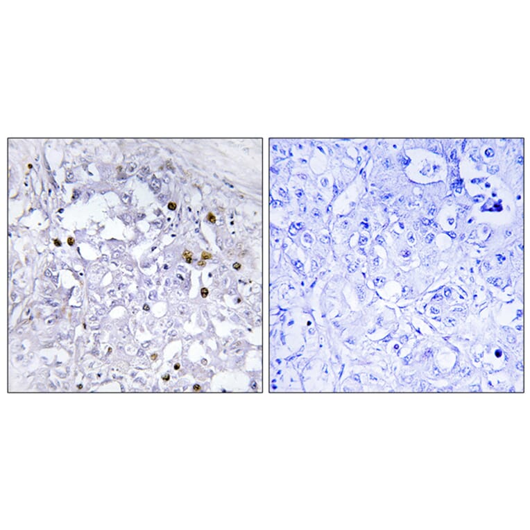 Immunohistochemistry - Anti-HNF4 alpha (phospho Ser313) Antibody (A7108) - Antibodies.com