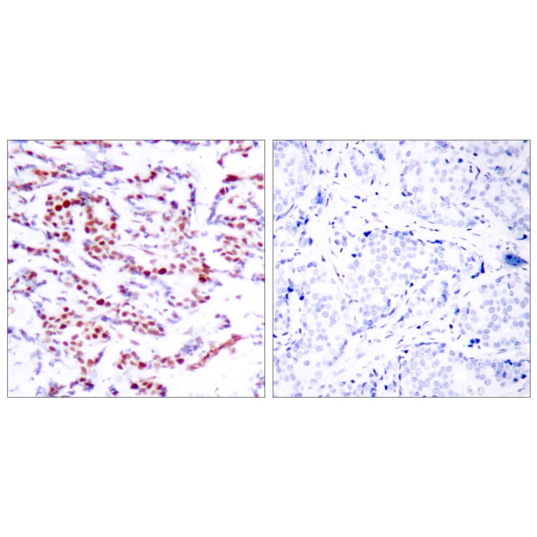 Immunohistochemistry - Anti-ATF2 (phospho Ser112 or 94) Antibody (A7012) - Antibodies.com