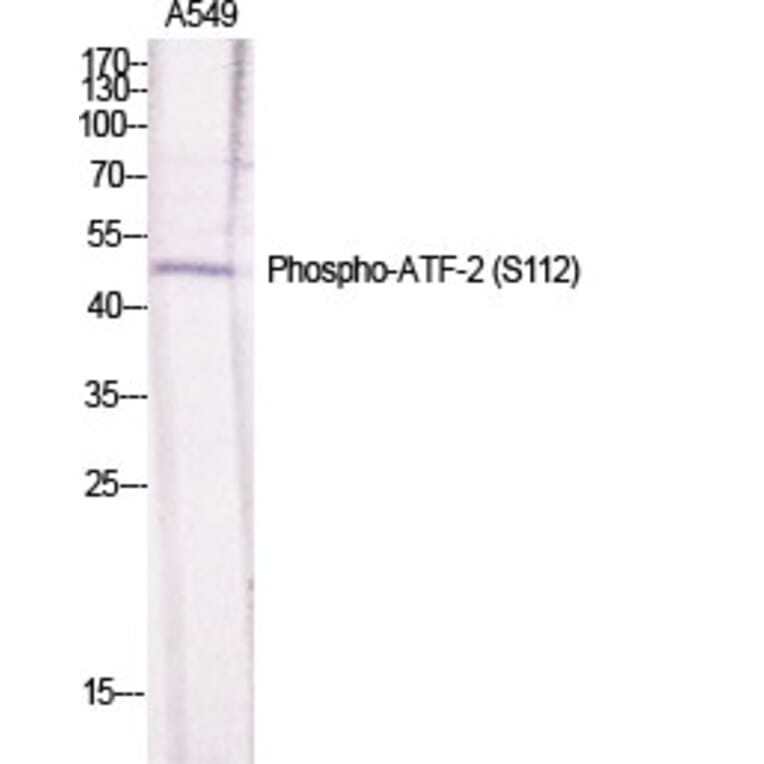 Western Blot - Anti-ATF2 (phospho Ser112 or 94) Antibody (A7012) - Antibodies.com