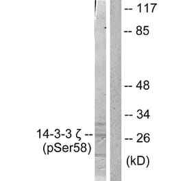 Western Blot - Anti-14-3-3 zeta (phospho Ser58) Antibody (A0001) - Antibodies.com
