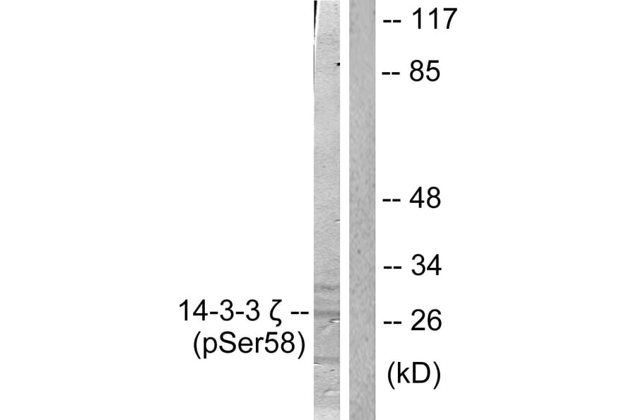 Western Blot - Anti-14-3-3 zeta (phospho Ser58) Antibody (A0001) - Antibodies.com