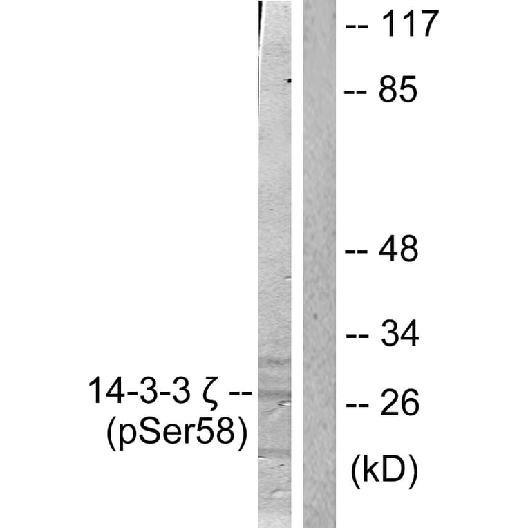 Western Blot - Anti-14-3-3 zeta (phospho Ser58) Antibody (A0001) - Antibodies.com