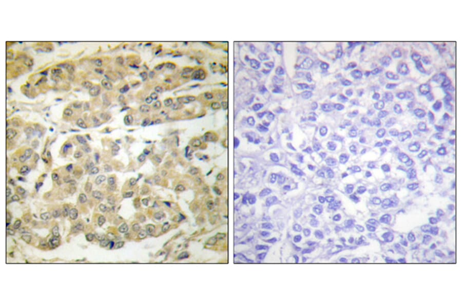 Immunohistochemistry - Anti-14-3-3 zeta (phospho Ser58) Antibody (A0001) - Antibodies.com