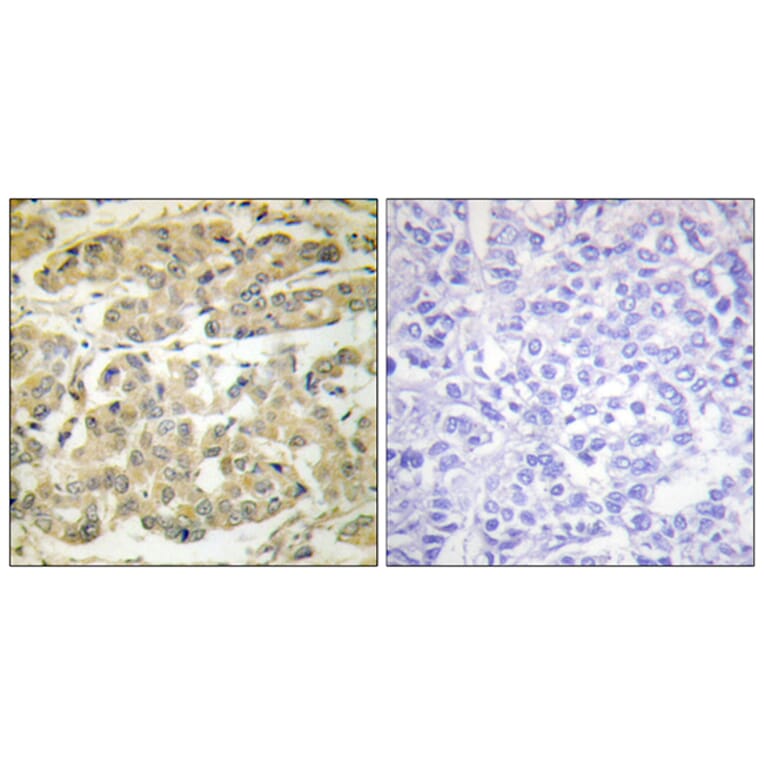 Immunohistochemistry - Anti-14-3-3 zeta (phospho Ser58) Antibody (A0001) - Antibodies.com