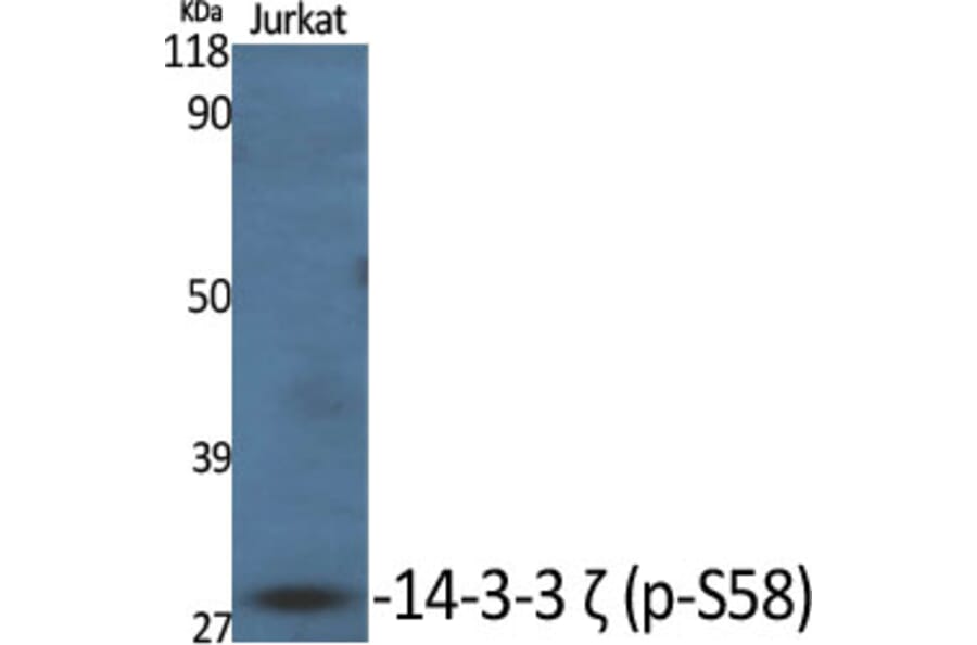 Western Blot - Anti-14-3-3 zeta (phospho Ser58) Antibody (A0001) - Antibodies.com