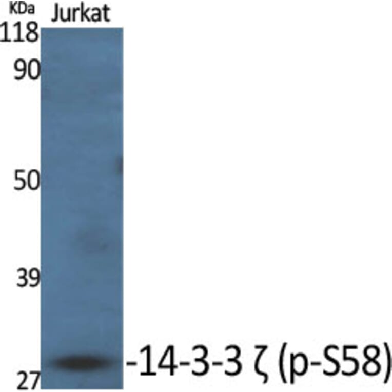 Western Blot - Anti-14-3-3 zeta (phospho Ser58) Antibody (A0001) - Antibodies.com