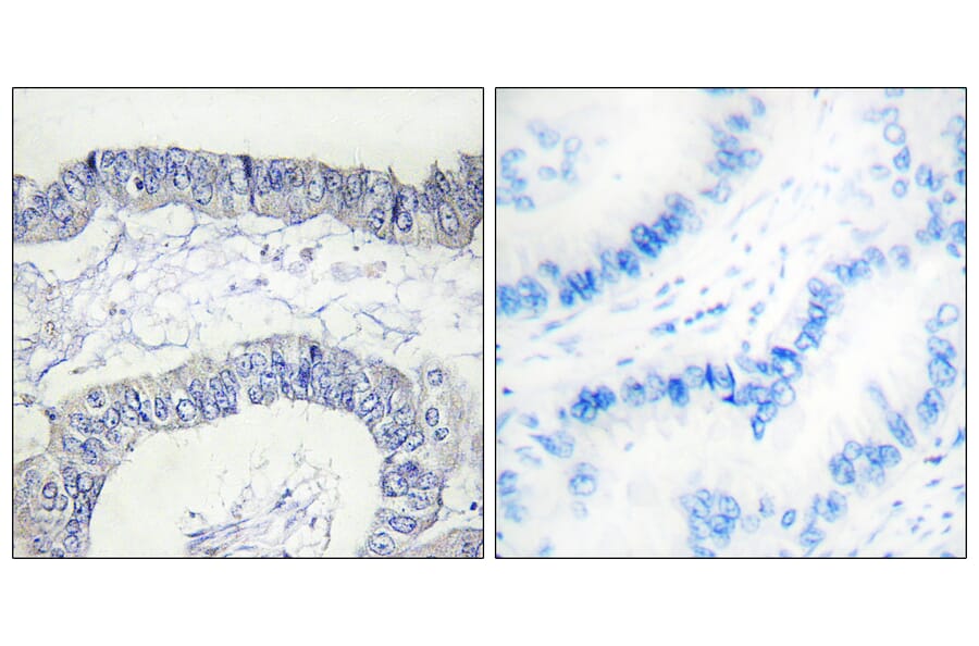 Immunohistochemistry - Anti-FA12 (heavy chain, cleaved Ile20) Antibody (L0204) - Antibodies.com
