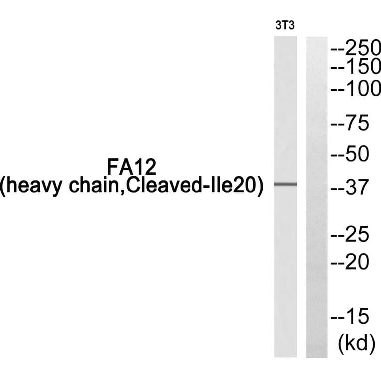 Western Blot - Anti-FA12 (heavy chain, cleaved Ile20) Antibody (L0204) - Antibodies.com