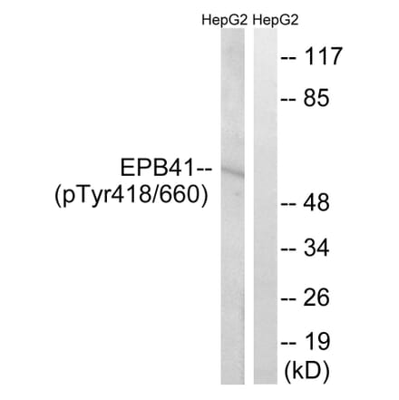 Western Blot - Anti-EPB41 (phospho Tyr660 + Tyr418) Antibody (A8341) - Antibodies.com