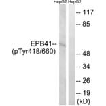 Western Blot - Anti-EPB41 (phospho Tyr660 + Tyr418) Antibody (A8341) - Antibodies.com