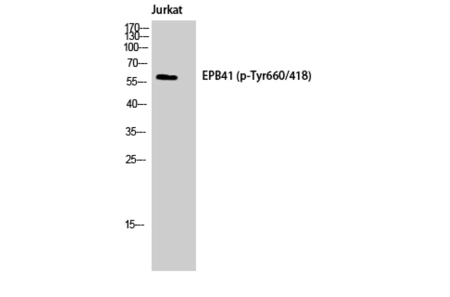 Western Blot - Anti-EPB41 (phospho Tyr660 + Tyr418) Antibody (A8341) - Antibodies.com