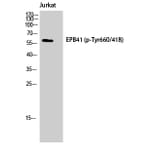 Western Blot - Anti-EPB41 (phospho Tyr660 + Tyr418) Antibody (A8341) - Antibodies.com
