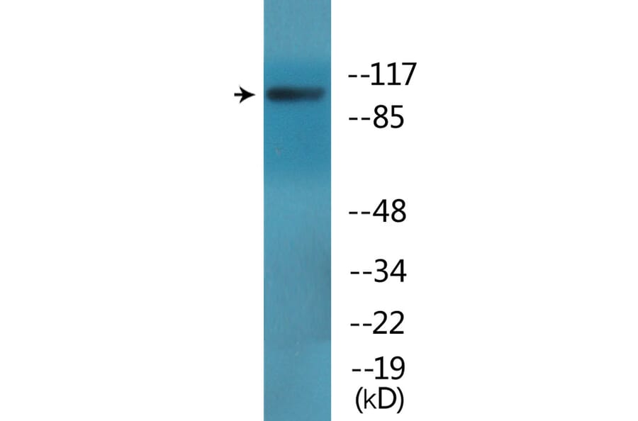 Western Blot - Anti-EPB41 (phospho Tyr660 + Tyr418) Antibody (P12-1101) - Antibodies.com