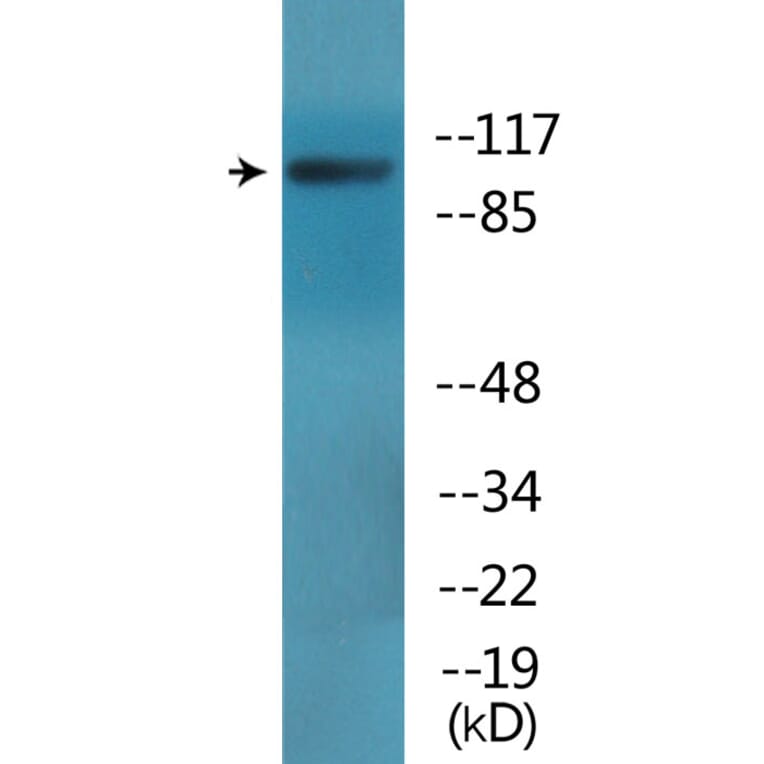 Western Blot - Anti-EPB41 (phospho Tyr660 + Tyr418) Antibody (P12-1101) - Antibodies.com