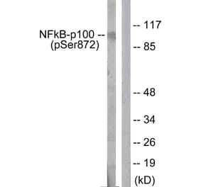 Western Blot - Anti-NF-kappaB p100 (phospho Ser872) Antibody (A1104) - Antibodies.com