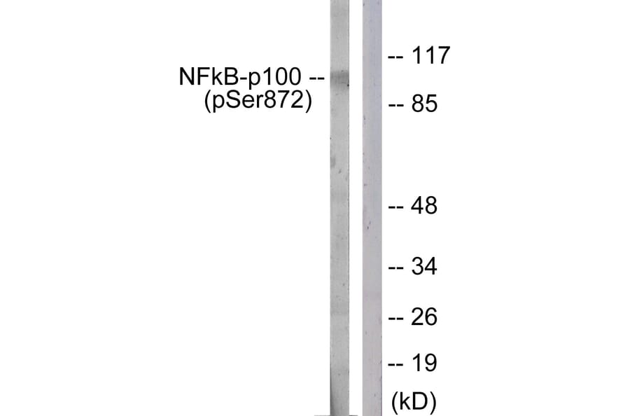 Western Blot - Anti-NF-kappaB p100 (phospho Ser872) Antibody (A1104) - Antibodies.com