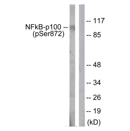 Western Blot - Anti-NF-kappaB p100 (phospho Ser872) Antibody (A1104) - Antibodies.com