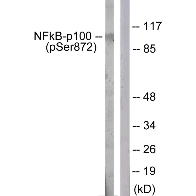 Western Blot - Anti-NF-kappaB p100 (phospho Ser872) Antibody (A1104) - Antibodies.com