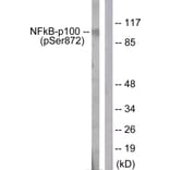 Western Blot - Anti-NF-kappaB p100 (phospho Ser872) Antibody (A1104) - Antibodies.com