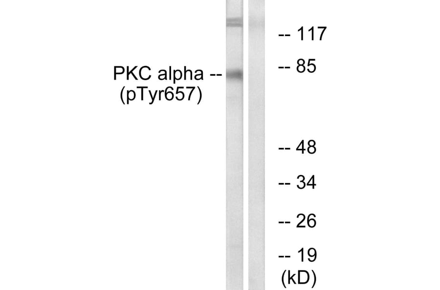 Western Blot - Anti-PKC alpha (phospho Tyr657) Antibody (A0800) - Antibodies.com