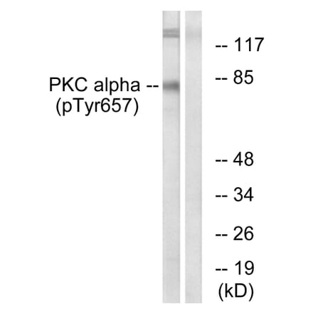 Western Blot - Anti-PKC alpha (phospho Tyr657) Antibody (A0800) - Antibodies.com