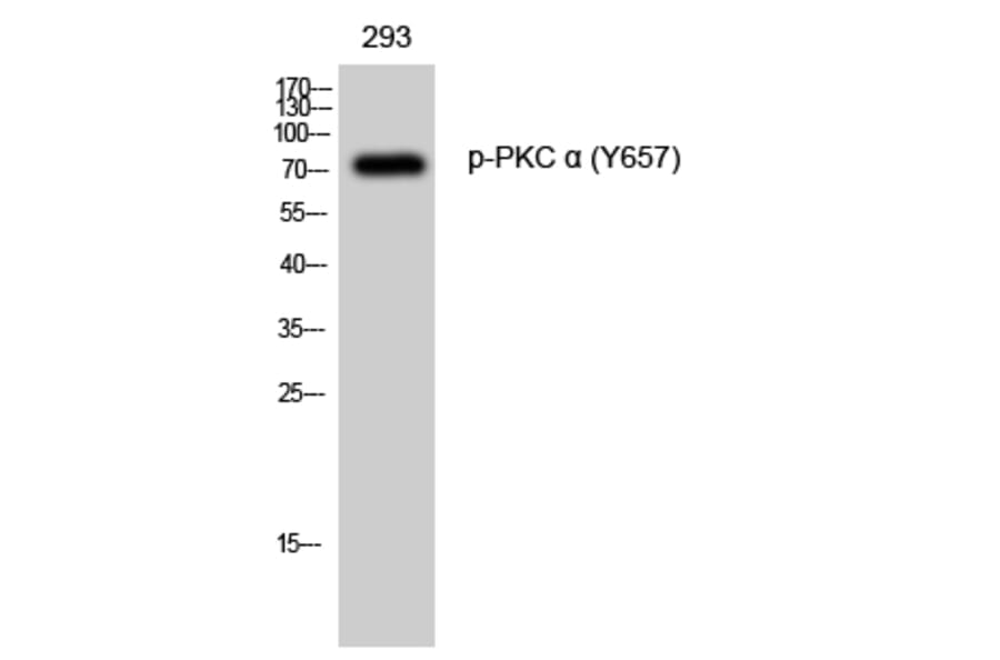 Western Blot - Anti-PKC alpha (phospho Tyr657) Antibody (A0800) - Antibodies.com