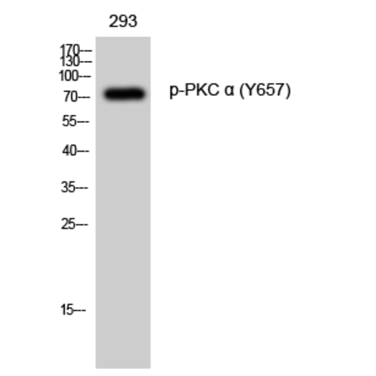 Western Blot - Anti-PKC alpha (phospho Tyr657) Antibody (A0800) - Antibodies.com