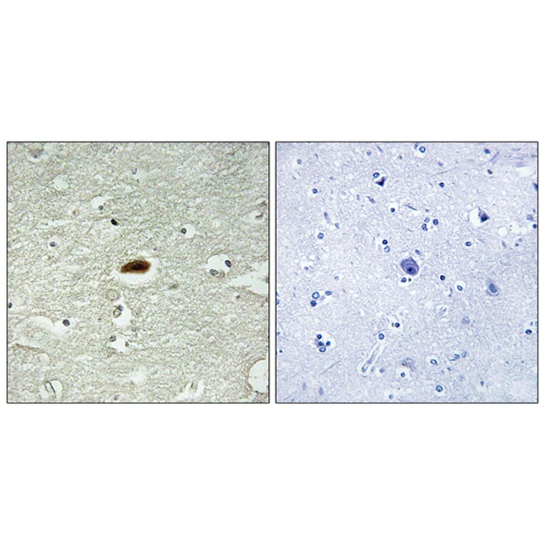 Immunohistochemistry - Anti-Period Circadian Protein 2 Antibody (B1223) - Antibodies.com