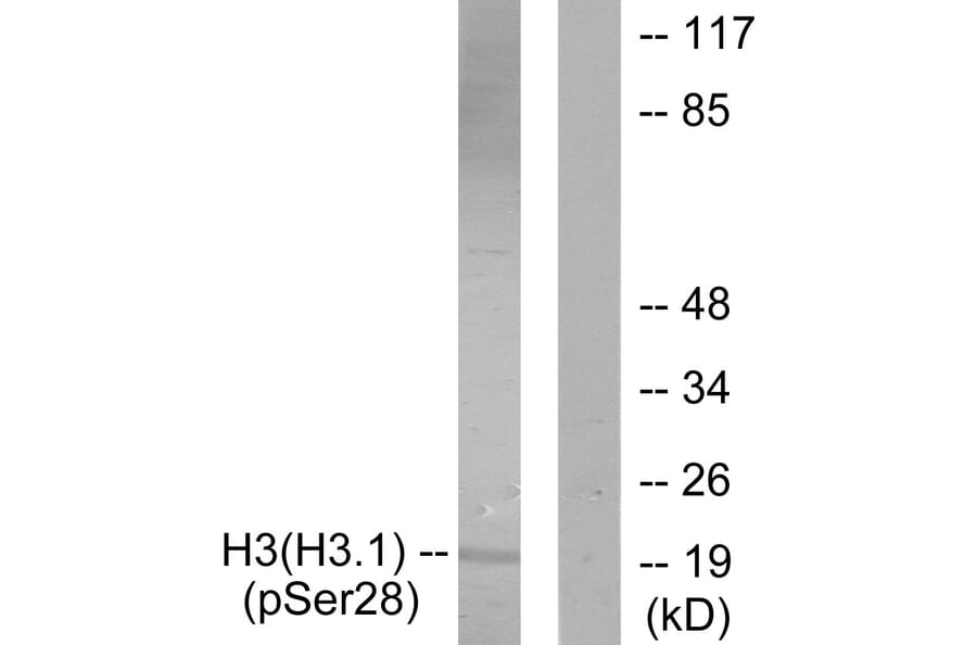 Western Blot - Anti-Histone H3 (phospho Ser28) Antibody (A0435) - Antibodies.com