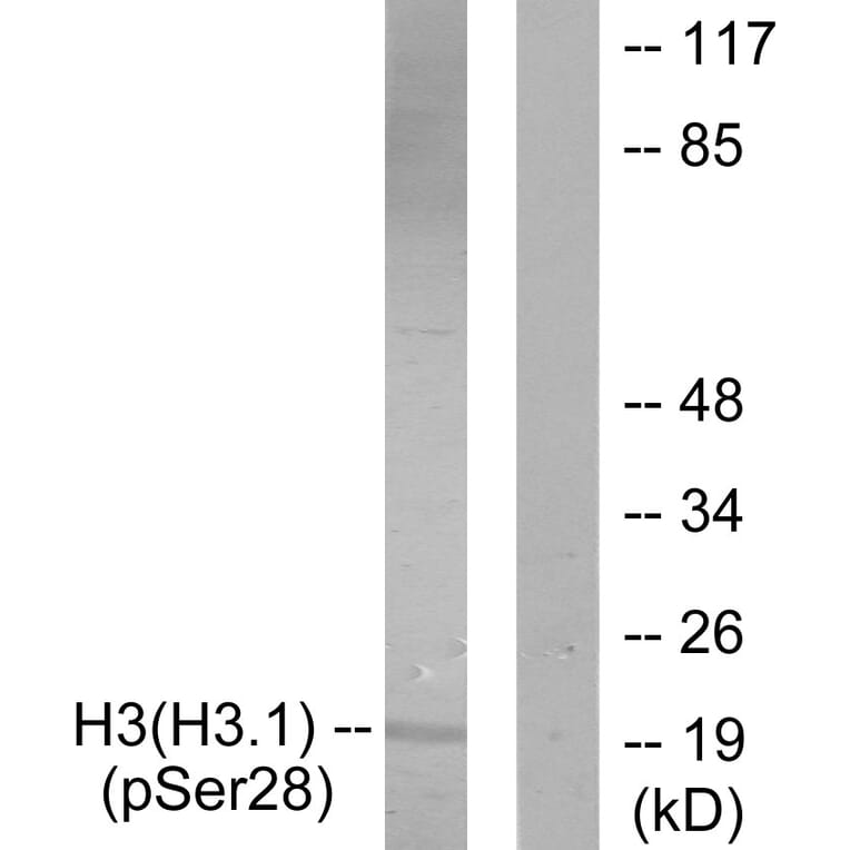 Western Blot - Anti-Histone H3 (phospho Ser28) Antibody (A0435) - Antibodies.com
