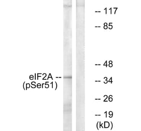 Western Blot - Anti-eIF2 alpha (phospho Ser51) Antibody (A7066) - Antibodies.com