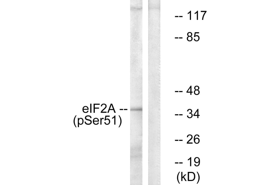 Western Blot - Anti-eIF2 alpha (phospho Ser51) Antibody (A7066) - Antibodies.com