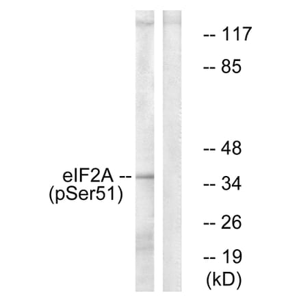 Western Blot - Anti-eIF2 alpha (phospho Ser51) Antibody (A7066) - Antibodies.com