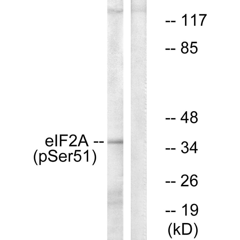 Western Blot - Anti-eIF2 alpha (phospho Ser51) Antibody (A7066) - Antibodies.com