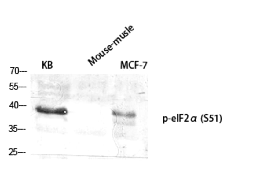 Western Blot - Anti-eIF2 alpha (phospho Ser51) Antibody (A7066) - Antibodies.com
