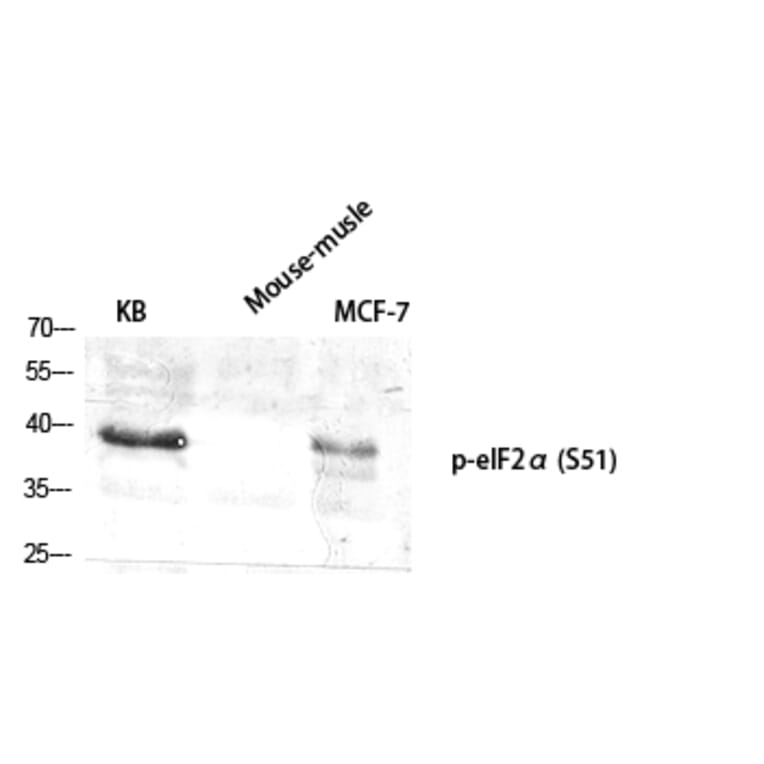 Western Blot - Anti-eIF2 alpha (phospho Ser51) Antibody (A7066) - Antibodies.com