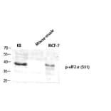 Western Blot - Anti-eIF2 alpha (phospho Ser51) Antibody (A7066) - Antibodies.com