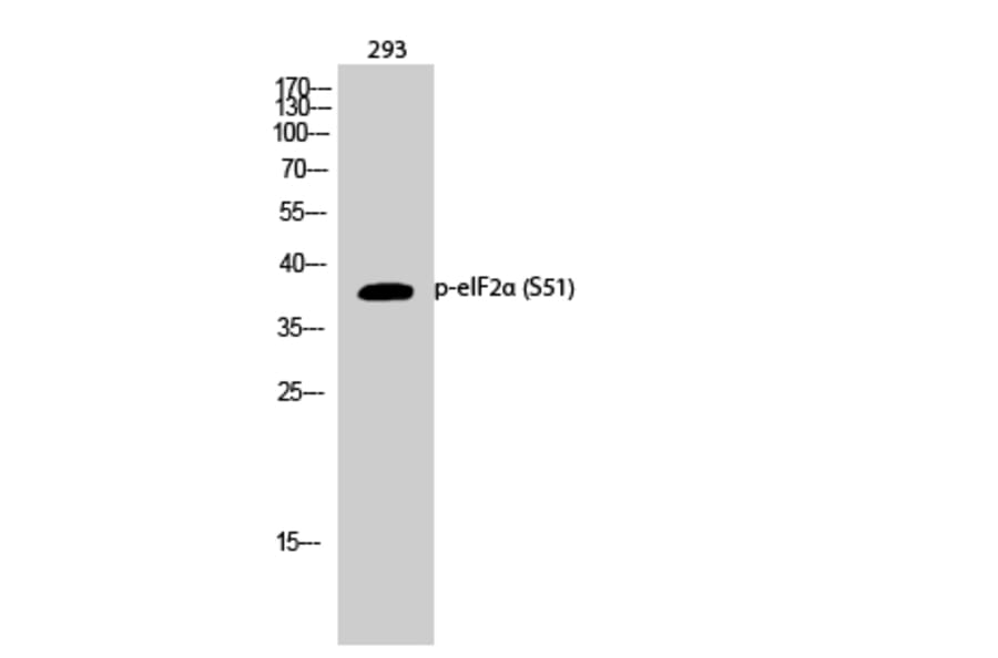 Western Blot - Anti-eIF2 alpha (phospho Ser51) Antibody (A7066) - Antibodies.com