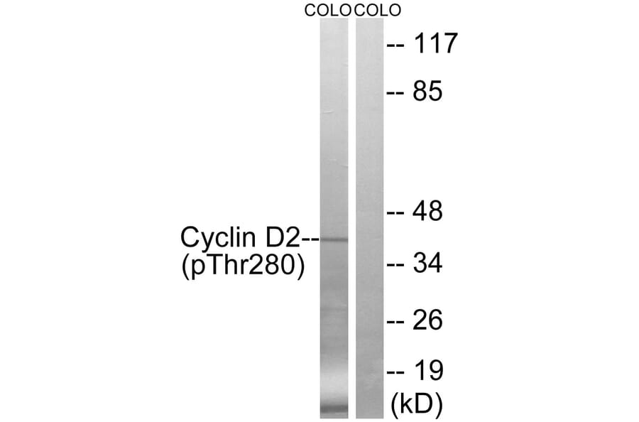 Western Blot - Anti-Cyclin D2 (phospho Thr280) Antibody (A8336) - Antibodies.com