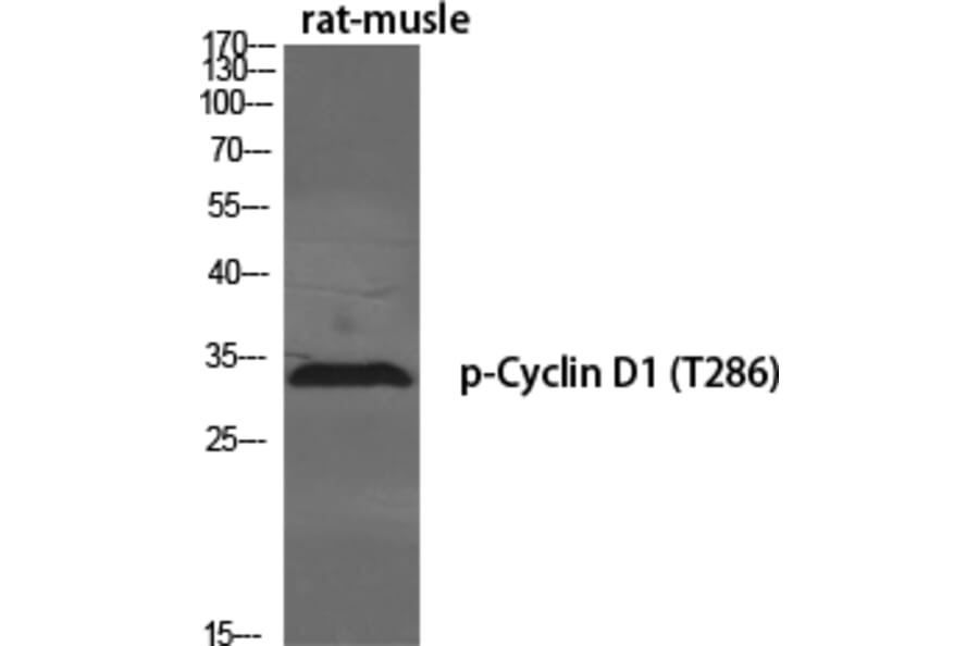 Western Blot - Anti-Cyclin D1 (phospho Thr286) Antibody (A0417) - Antibodies.com